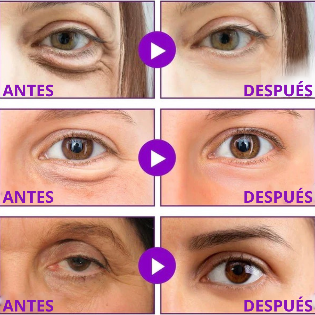 Mini Parches de ácido hialurónico- Pack de 6 Unidades