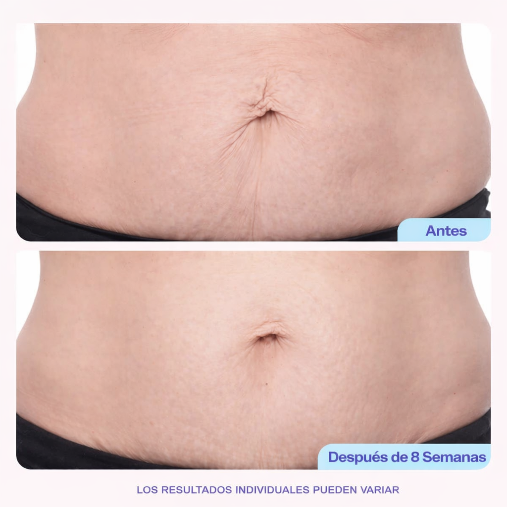 Crema reafirmante y alisadora para el abdomen