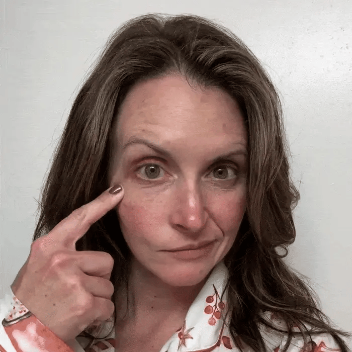 Mini Parches de ácido hialurónico- Pack de 6 Unidades